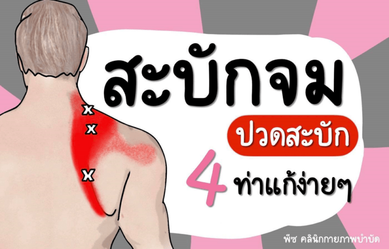 ปวดสะบัก สะบักจม อย่าปล่อยไว้เป็นอันขาด รู้เร็วแก้ไขทันที